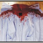 근무하는 직장에서 <b>명패</b>로 폭행당하고 또 무차별 폭행을 당했습니다