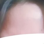 [댓글부탁해] (극혐주의)<b>생리</b>여드름 ㅅ ㅣ발년아