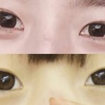 [댓글부탁해] 앞트임망함ㅅ.ㅂ(사진많음)
