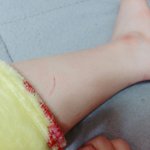 시방 이게 <b>발톱</b>이여 커터칼이여