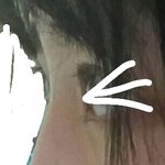 [조언부탁해] 코 수술하려는데..