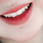 내 <b>치아</b> 어때? ㅜㅜ