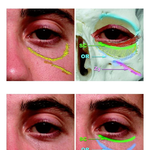 [꼭댓글부탁] 유전적인 인디언<b>주름</b> 그냥 받아들이고 사시나요