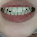 [댓글부탁해] 사진ㅇ)송곳니 다들 어떻게 생김?