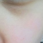 다크<b>서클</b>없애는법아는사람??