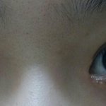 개학 <b>쌍수</b>붓기