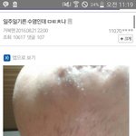 [EXO] 어금니 뭰