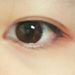 나 <b>쌍꺼풀</b> 두꺼워짐