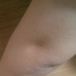 [드루와] 팔꿈치 하얘지는 법 아는사람ㅠㅠ