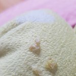 [댓글부탁해] 코딱지개<b>이득</b>