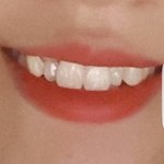 [댓글부탁해] <b>덧니</b>ㅇㄸ