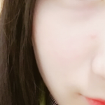 [사진유] 학교 <b>히터</b> 때문에 피부 다 뒤집어짐 ㅠㅠ