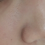 [댓글부탁해] (약혐)후면으로찍으니까 <b>피부개</b>심각하다