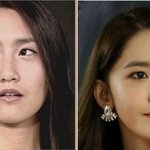 연예인들이 얼굴 성형빨인 이유