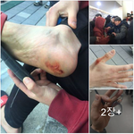 서울대 <b>본부</b> 침탈, 알고 계신가요?