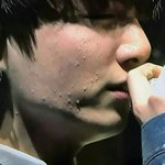 [EXO] 빻)<b>수세미</b>로 박박 긁어서 여드름 퇴치하고싶다ㅠㅅㅠ