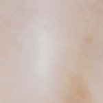 [조언부탁해] 나 쌍수 다시 할건데