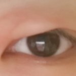 [조언부탁해] 다래끼?주의)ㅅㅂㅜㅜㅜ애들이 다래끼라는데