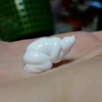 눈 <b>충혈</b> 되고 아파서 병원왔는데