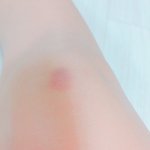 [댓글부탁해] 내가 멍이 드는 이유를 <b>서술</b>하여라