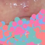 [드루와] 얘들아 입 안에 <b>물집</b>? 같은거 났는데 이거 뭐야?