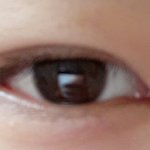 중2쌍수조언