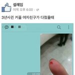 [공미니] 3년사귄 커플 <b>여자</b><b>친구</b>가 다쳤을<b>때</b>...
