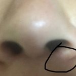 [댓글부탁해] 부작용인가?