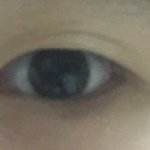 [조언부탁해] 쌍수 ㅠㅠ 고민중인데