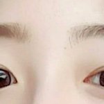 쌍수절개 + 눈매교정 2<b>달째</b> 사진ㅎㅎ