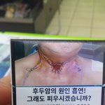 담배혐오포스터 혐오사진<b>포함</b>