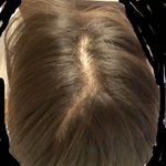 [댓글부탁해] <b>더러움주</b>의) 일주일동안 머리 안감기 후기