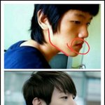 [EXO] 백현 턱 <b>성형</b>
