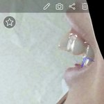 나보다 부정<b>교합</b> 심한사람?