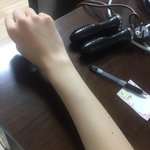 [댓글부탁해] 잉?내 팔도 징그러운<b>거여</b>..?