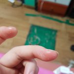 이거 <b>각질</b>임 ??