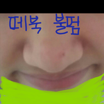 [조언부탁해] 나처럼 코 이런 사람 있냐 ㅠㅠ(<b>존</b><b>못</b>주의)