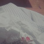 [조언부탁해] 얘들아 여드름에서 갑자기 <b>피나</b>와(사진0)
