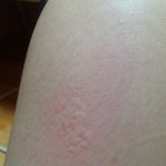 [조언부탁해] <b>이런</b>게 <b>몸</b>에났어;;;뭐야?
