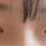 [댓글부탁해] 나 <b>쌍수</b> 잘됐다고 말해줭..