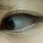 [댓글부탁해] 이거 눈 <b>주름</b>이야?ㅠㅠ