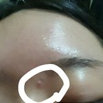 <b>피지</b>??같은게 올라와 얼굴에