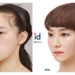 오~~ <b>정원</b>이 성형하니까 이뻐지는데