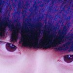 안검<b>하수</b>하면 좀 내려감?