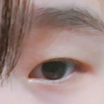 [댓글부탁해] 쌍수 해도 괜찮을까?
