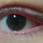 [댓글부탁해] 나만큼 쌍수 망한사람 있으면 나와봥