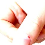 [드루와] 나 손톱 <b>안쪽</b> 살에서 피나는데 어떡ㅎ