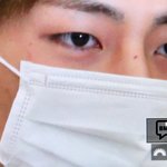 [방탄소년단] 태형이 얼굴 <b>상처</b>..ㅜㅜ