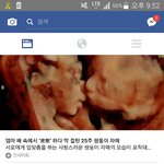 [댓글부탁해] 나 어제 페북보다가ㅜ신기햐서 <b>캡쳐</b>했는데