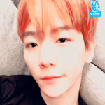 [EXO] 변백현 쌍수 재수술 했지???